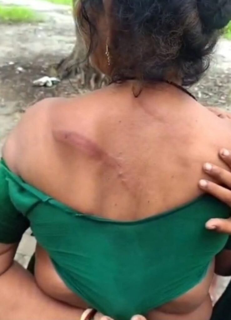 Sakaldiha Police Woman Beating Viral Video